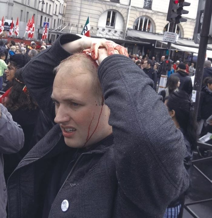 Agression d'un militant UPR : l’état alarmant de la démocratie en France